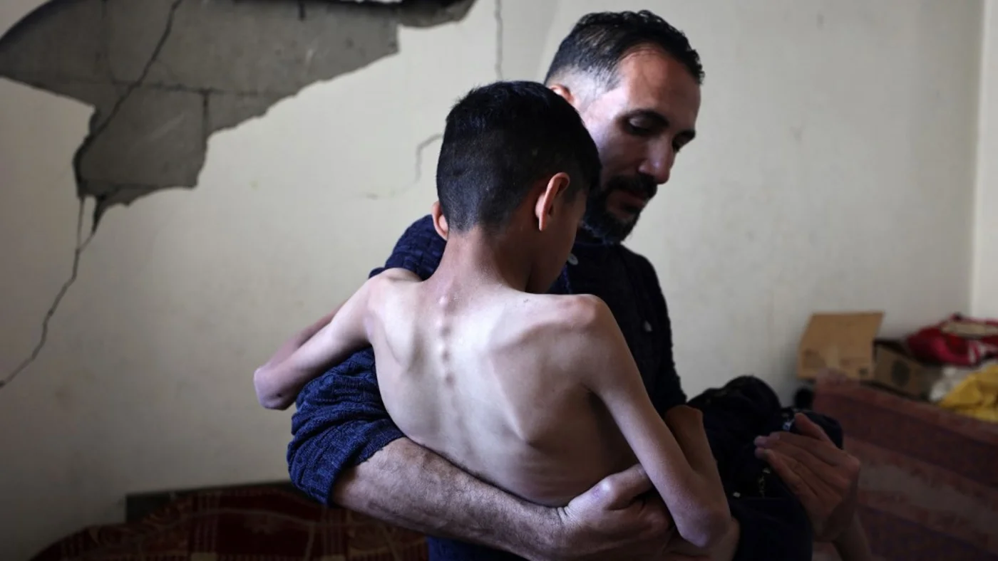 A 13-year-old Palestinian boy, whose family say he suffers from malnutrition, is carried by his father at their home in Gaza’s Bureij refugee camp on 12 April 2025 (Eyad Baba/AFP)
